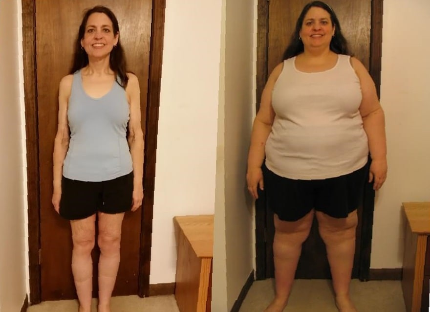 gastric-sleeve-before-and-after-3-months-1