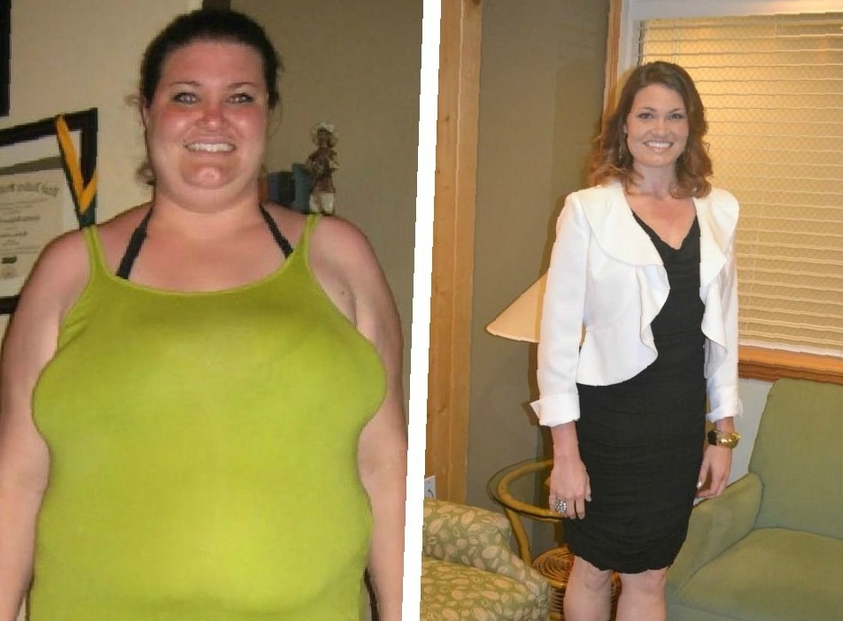 gastric-sleeve-before-and-after-3-months-4