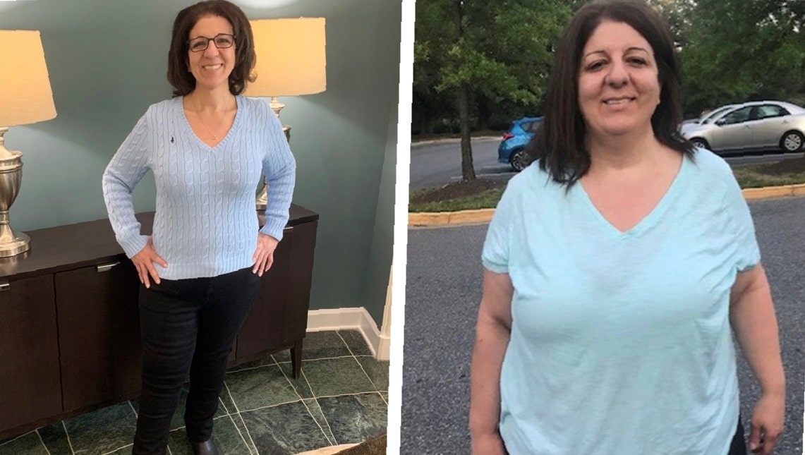 gastric-sleeve-before-and-after-3-months-5