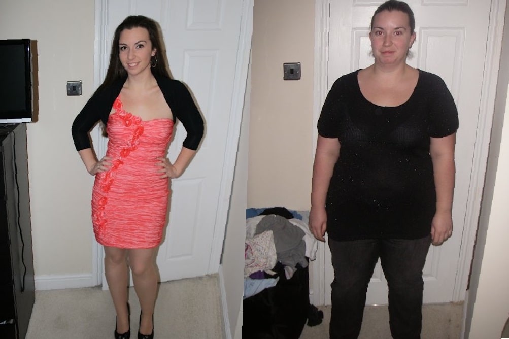 gastric-sleeve-before-and-after-3-months-7